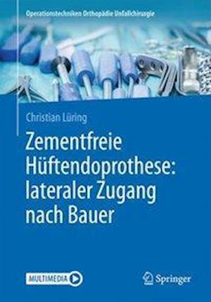 Zementfreie Huftendoprothese: lateraler Zugang nach Bauer