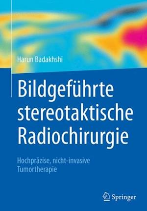 Bildgeführte stereotaktische Radiochirurgie