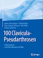 100 Clavicula-Pseudarthrosen
