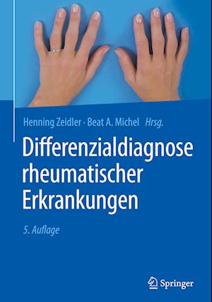 Differenzialdiagnose rheumatischer Erkrankungen