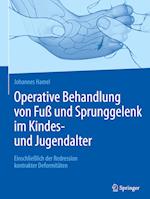 Operative Behandlung von Fuß und Sprunggelenk im Kindes- und Jugendalter