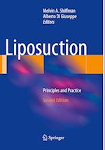 Liposuction