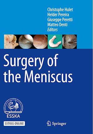 Surgery of the Meniscus