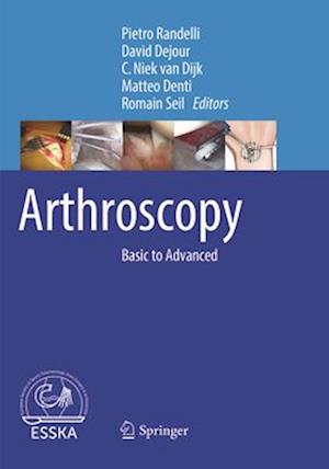 Arthroscopy