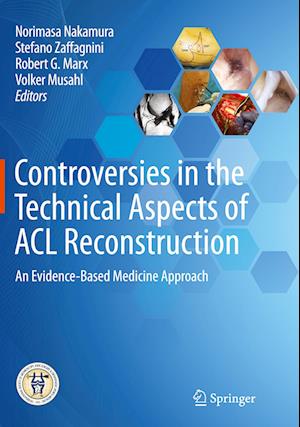 Controversies in the Technical Aspects of ACL Reconstruction