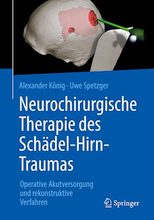 Neurochirurgische Therapie des Schädel-Hirn-Traumas