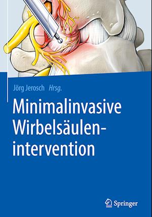 Minimalinvasive Wirbelsäulenintervention