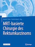 MRT-basierte Chirurgie des Rektumkarzinoms