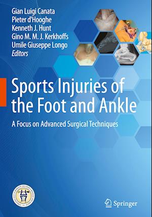 Sports Injuries of the Foot and Ankle