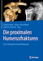 Die proximalen Humerusfrakturen