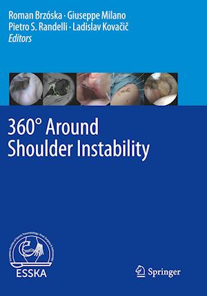 360° Around Shoulder Instability