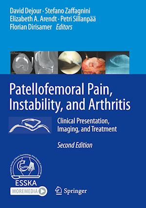 Patellofemoral Pain, Instability, and Arthritis