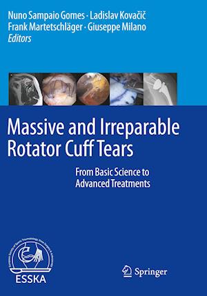 Massive and Irreparable Rotator Cuff Tears