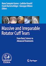 Massive and Irreparable Rotator Cuff Tears