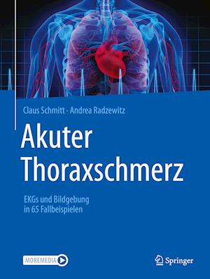 Akuter Thoraxschmerz