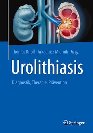 Urolithiasis