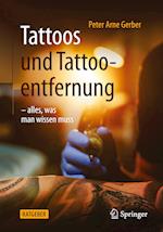 Tattoos und Tattooentfernung