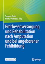 Prothesenversorgung Und Rehabilitation Nach Amputation Und Angeborener Fehlbildung