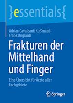 Frakturen der Mittelhand und Finger