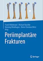 Periimplantäre Frakturen