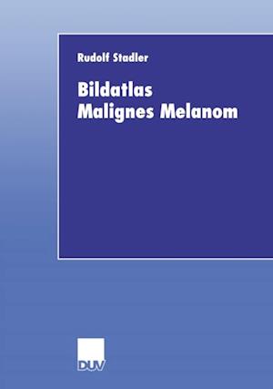 Bildatlas Malignes Melanom