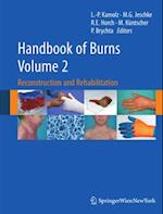 Handbook of Burns Volume 2