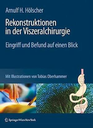 Rekonstruktionen in Der Viszeralchirurgie