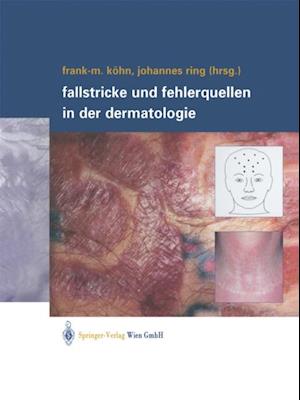 Fallstricke und Fehlerquellen in der Dermatologie