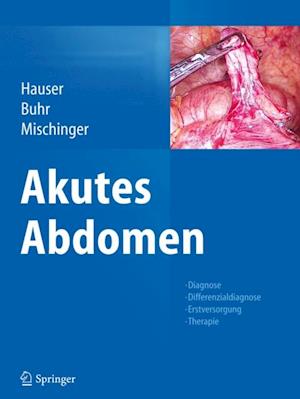 Akutes Abdomen