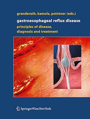 Gastroesophageal Reflux Disease