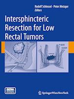 Intersphincteric Resection for Low Rectal Tumors
