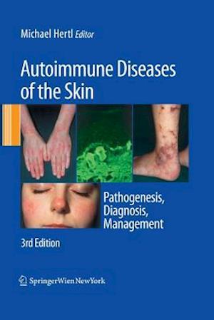 Autoimmune Diseases of the Skin