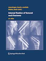 Internal fixation of femoral neck fractures