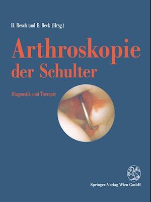 Arthroskopie der Schulter