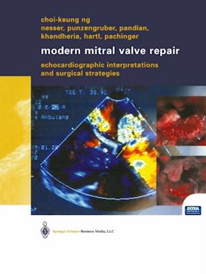 Modern Mitral Valve Repair