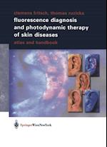 Fluorescence Diagnosis and Photodynamic Therapy of Skin Diseases