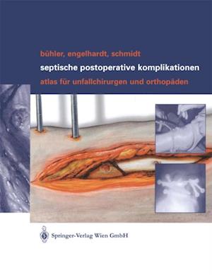 Septische postoperative Komplikationen