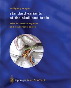 Standard Variants of the Skull and Brain