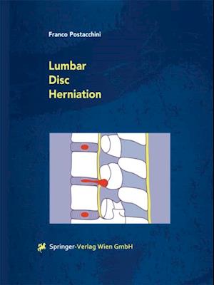 Lumbar Disc Herniation