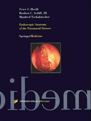 Endoscopic Anatomy of the Paranasal Sinuses