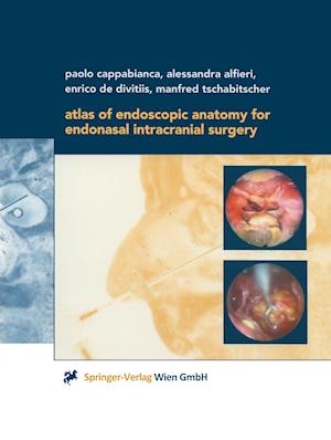 Atlas of Endoscopic Anatomy for Endonasal Intracranial Surgery