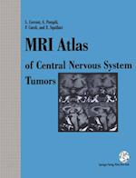MRI Atlas of Central Nervous System Tumors