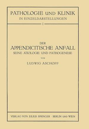 Der Appendicitische Anfall Seine Ätiologie Und Pathogenese.