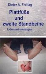 Plattfüße und zweite Standbeine