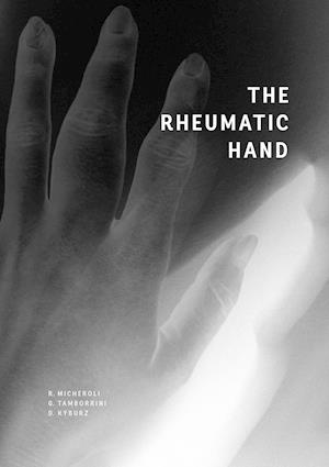 The Rheumatic Hand