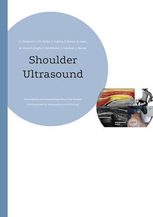 Imaging of the Shoulder