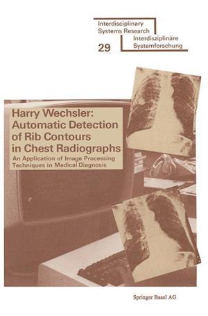 Automatic Detection of Rib Contours in Chest Radiographs