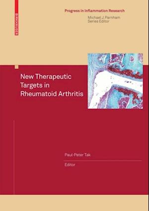 New Therapeutic Targets in Rheumatoid Arthritis