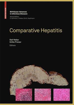 Comparative Hepatitis