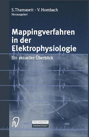 Mappingverfahren in der Elektrophysiologie